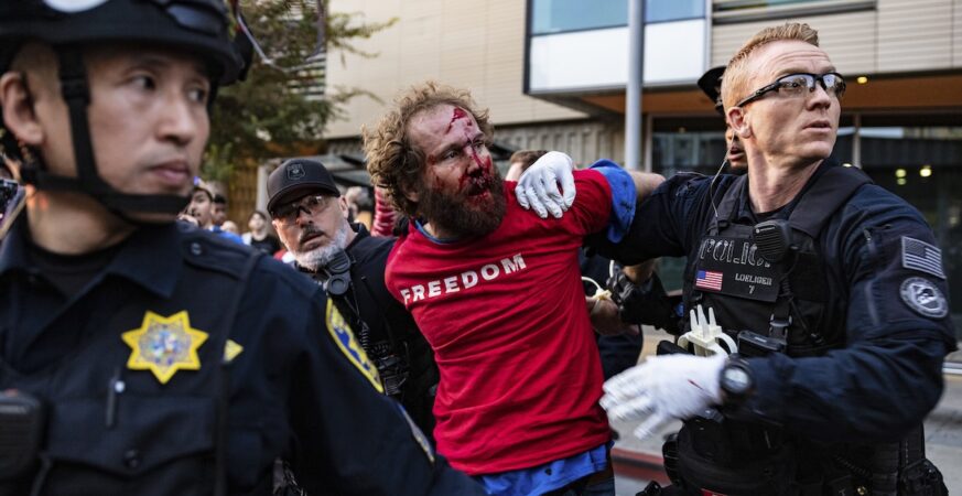 Antifa violence at UC Berkeley TPUSA event: 'Jihad' thrashes Charlie Kirk supporter, leaves him with a bloody face